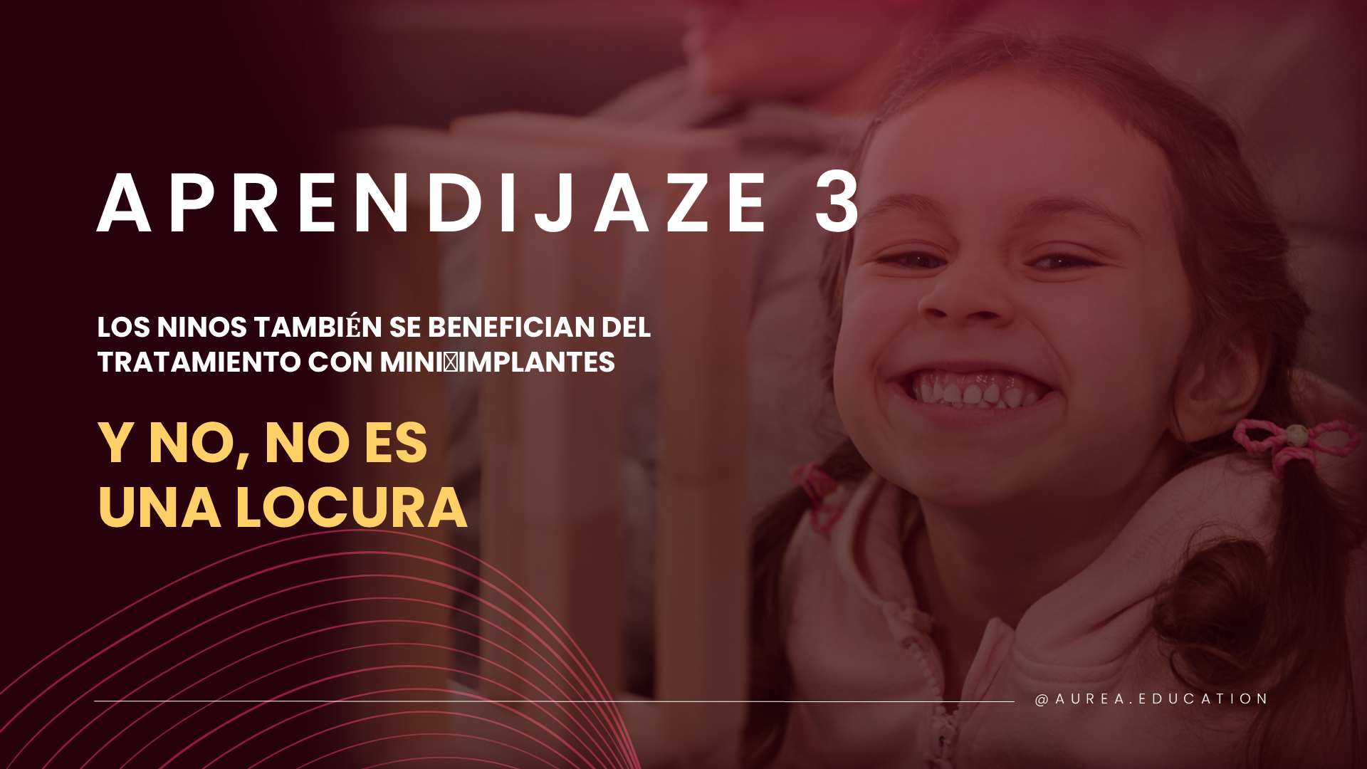 Aplicación clínica de mini implantes en Ortodoncia